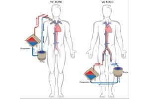 PowerClip Rectangle (7)